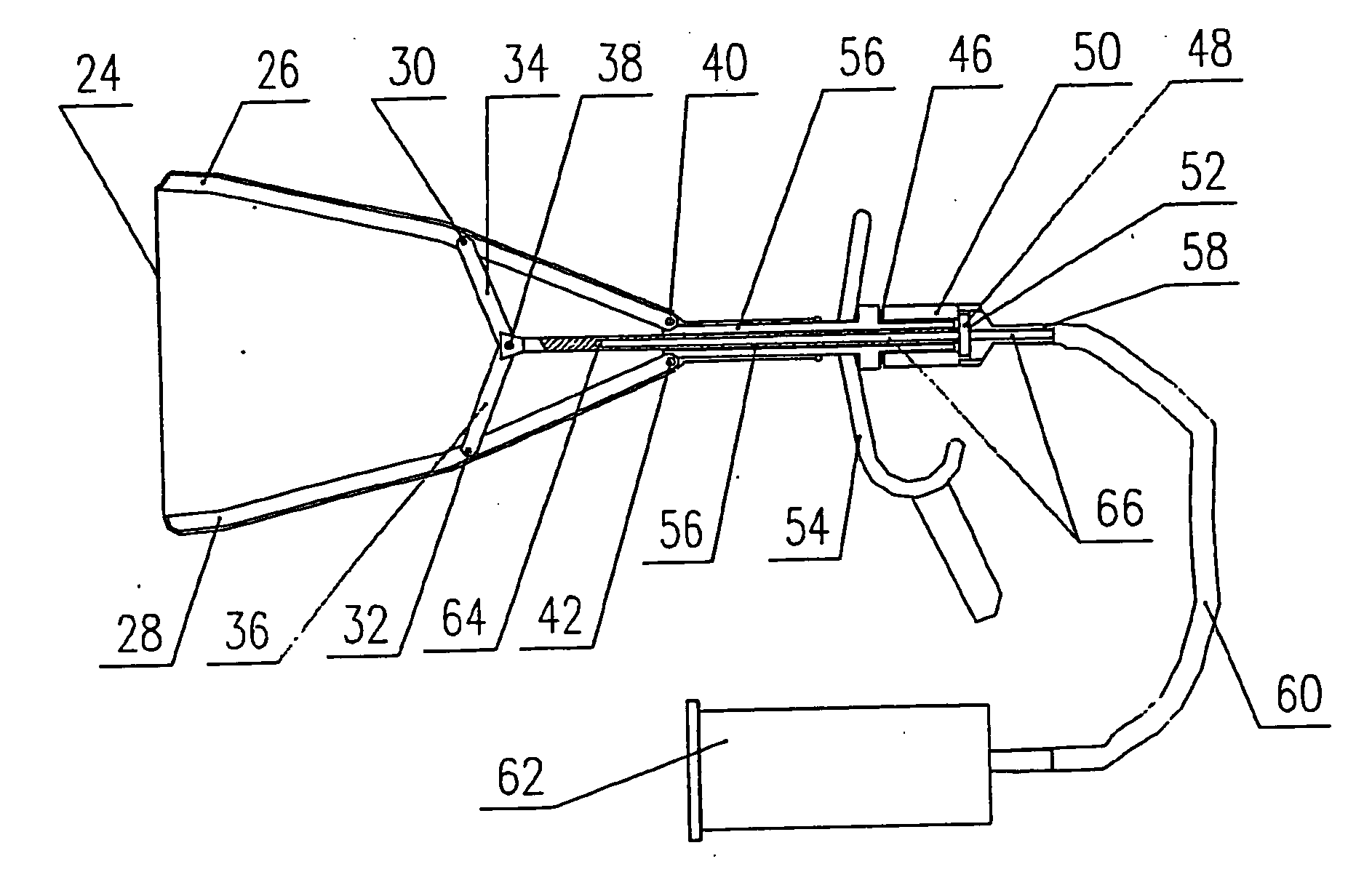 Apparatus for Body Cavity Delivery with Medium, Body Cavity Leading-in and Ultrasound Block