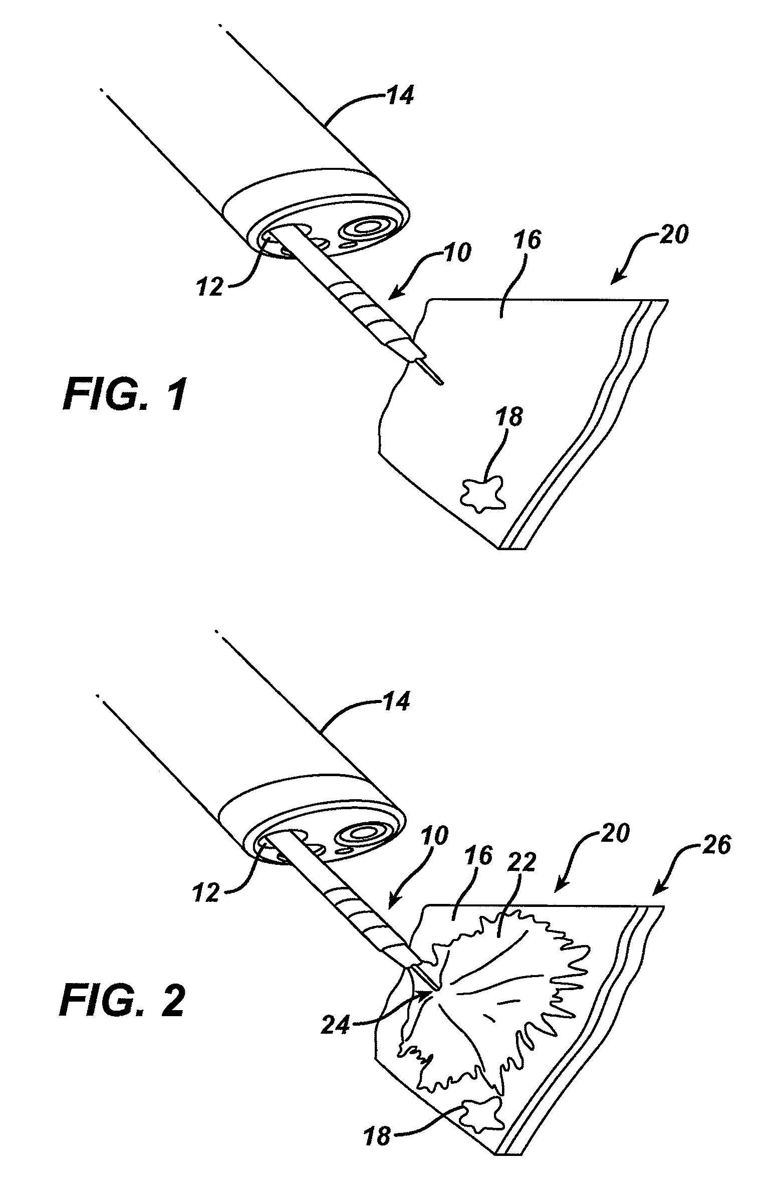 Intraluminal tissue markers