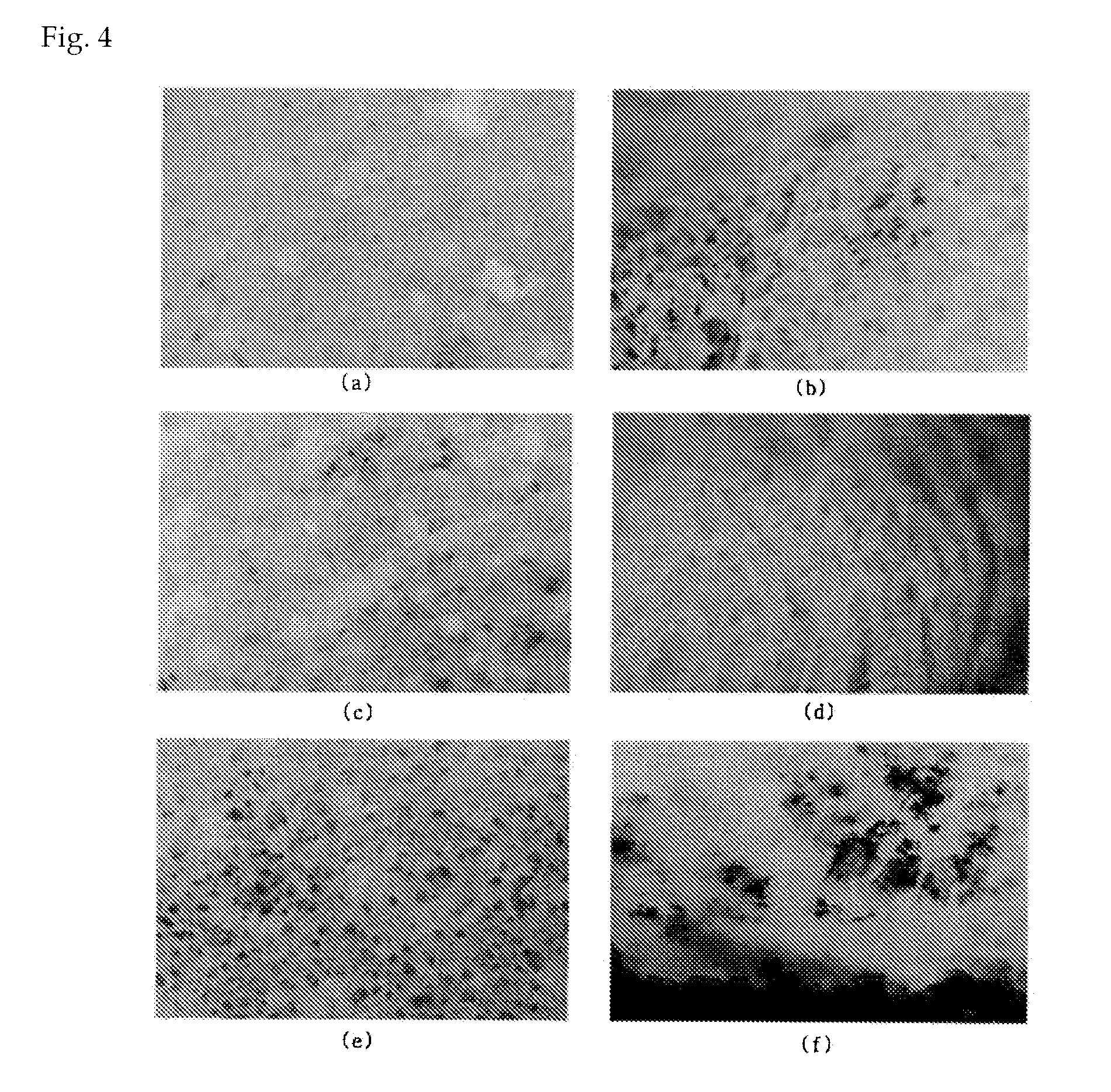 Pharmaceutical compositions and formulations of metformin extended release tablets