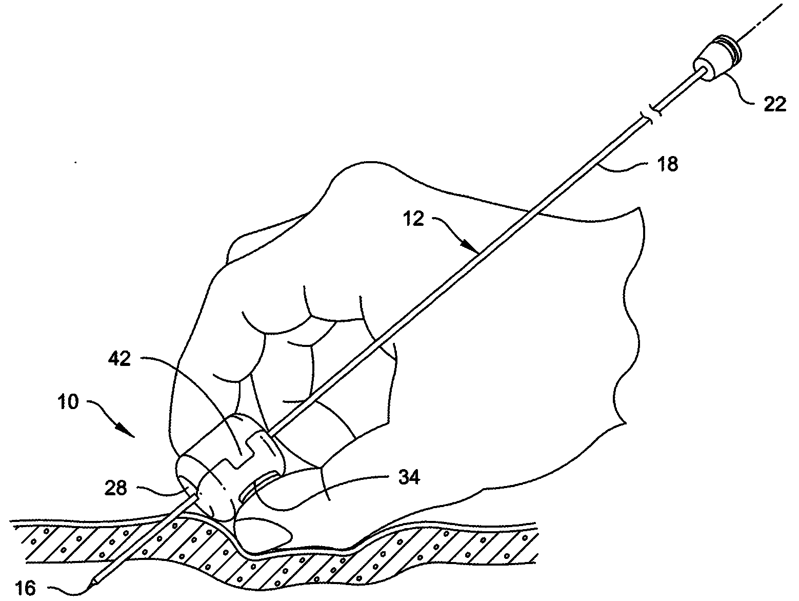 Catheter positioning system