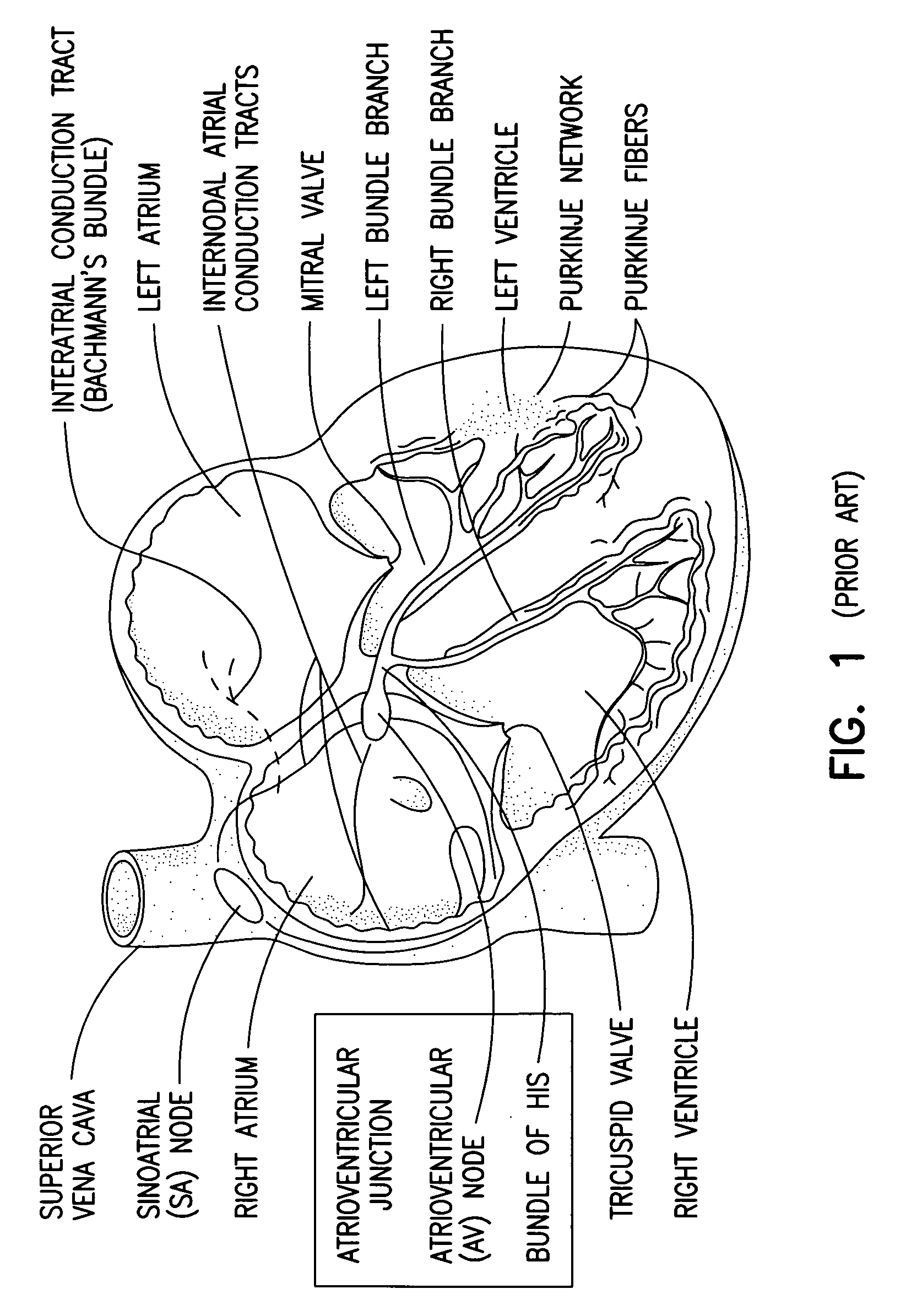 Implantable cardiac stimulator with electrode-tissue interface characterization