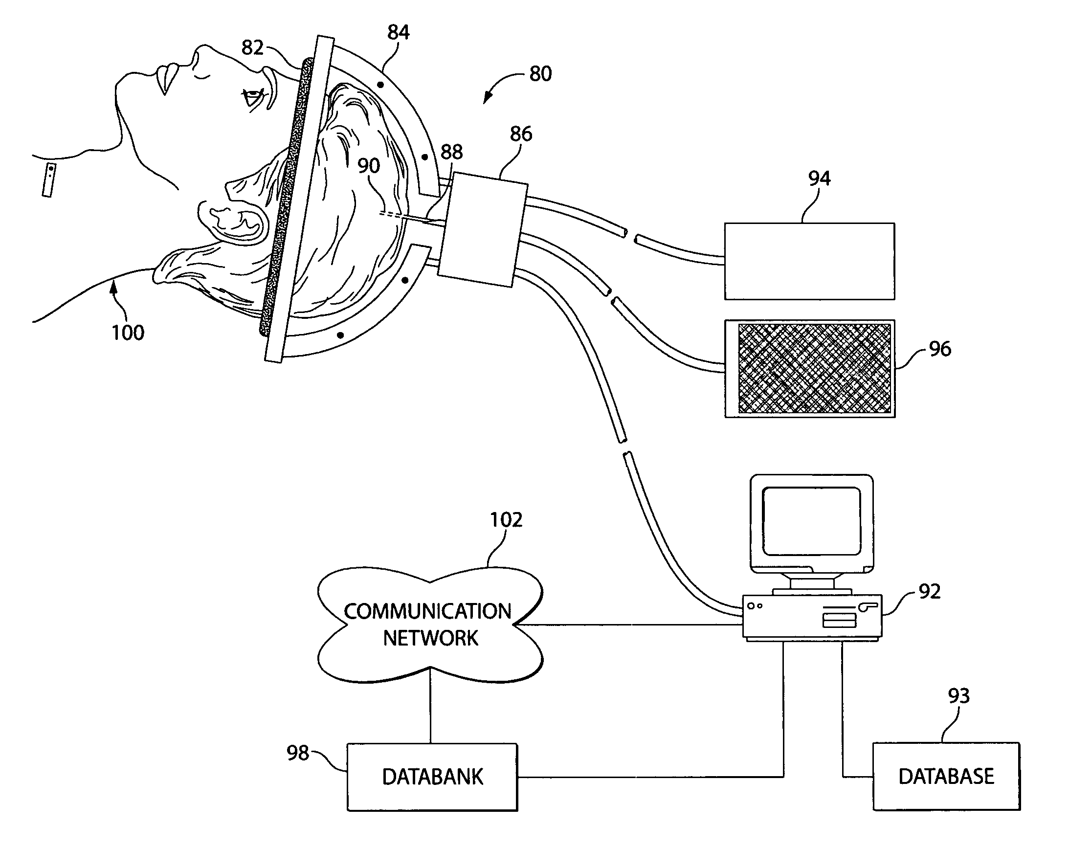 Deep brain stimulation