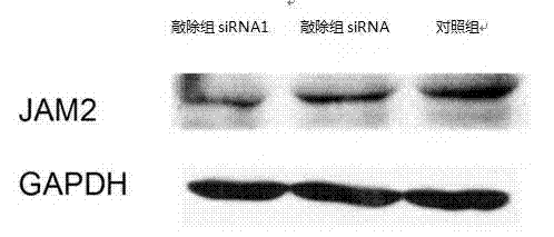 Method for targeted inhibition of infiltration and transfer of glioma cells and application of method