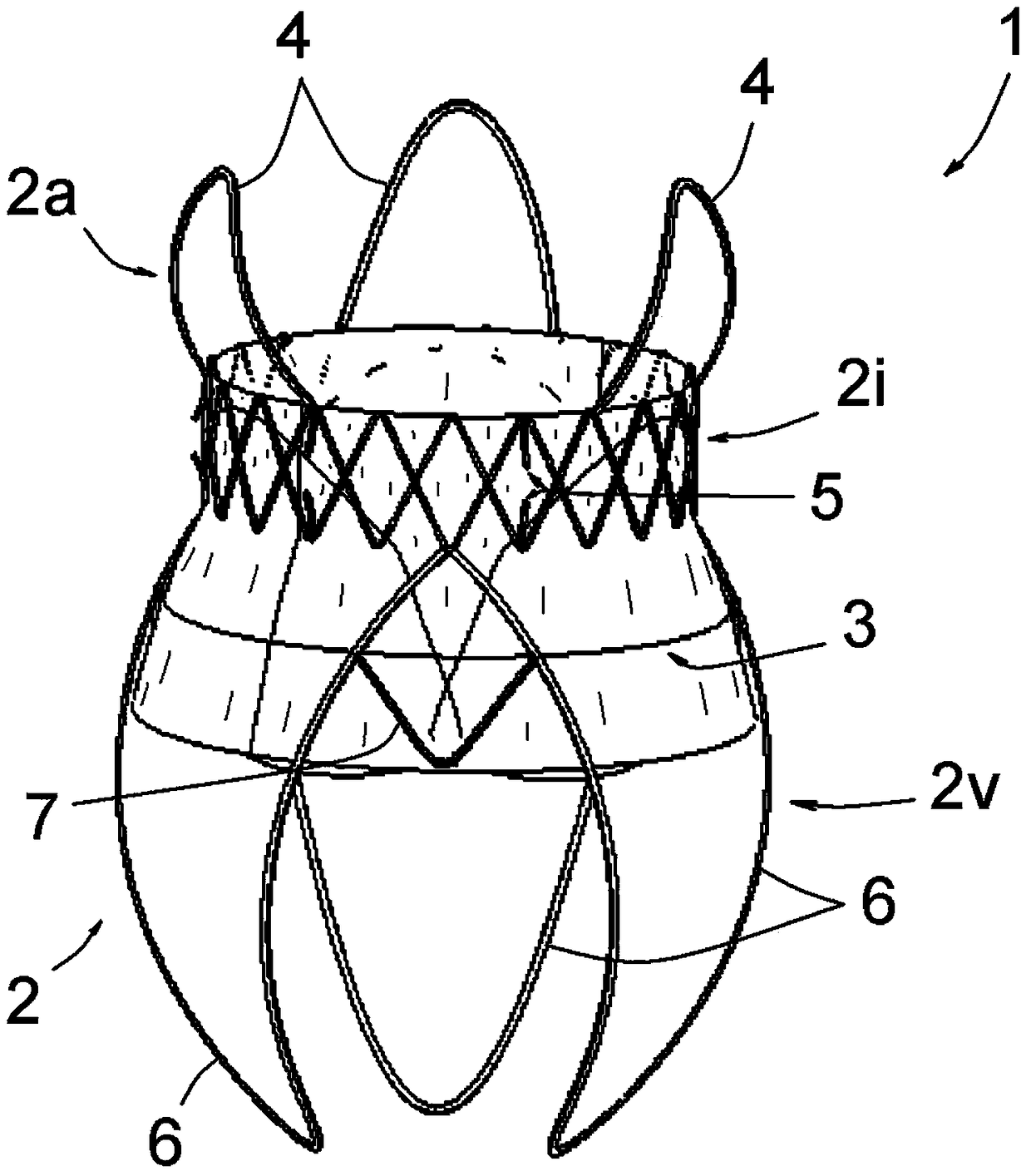 Mitral or tricuspid heart valve prosthesis