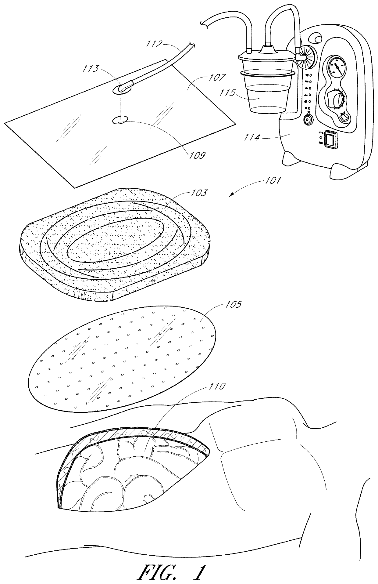 Systems and methods for applying reduced pressure therapy