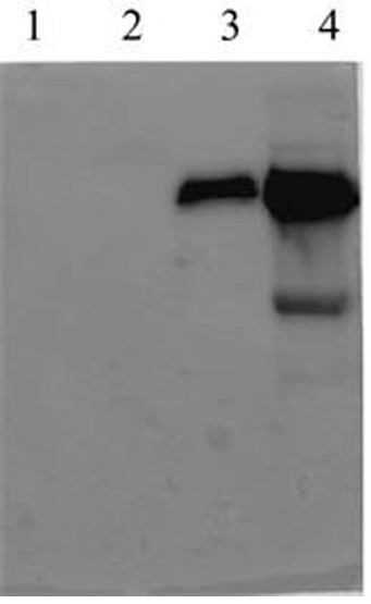 Blocking ELISA kit for detecting neutralizing antibodies of bovine infectious rhinotracheitis virus and its application