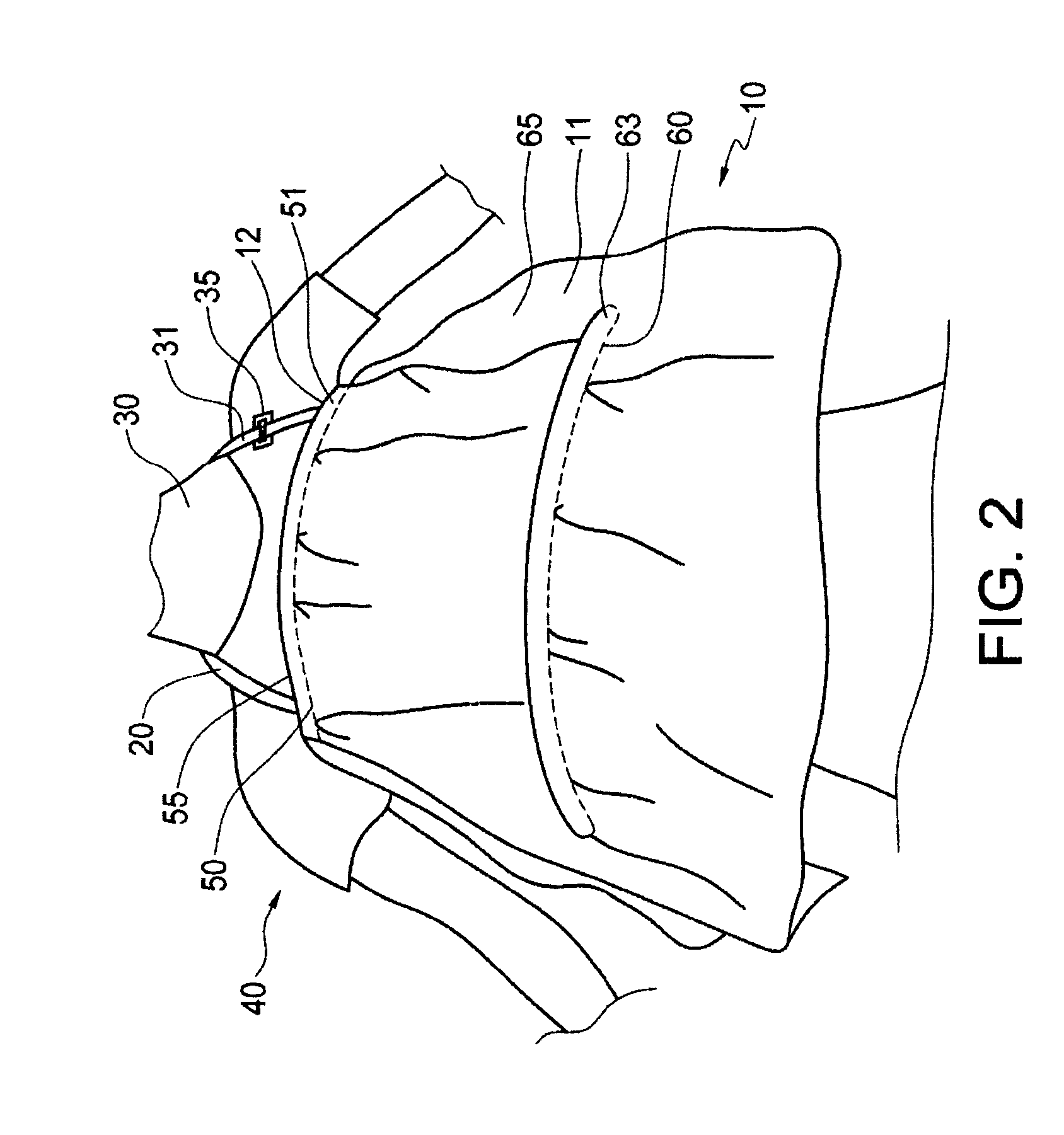 Nursing canopy