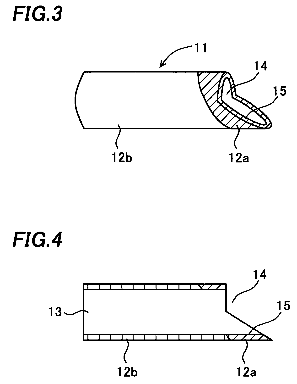 Suction tip for dental treatment