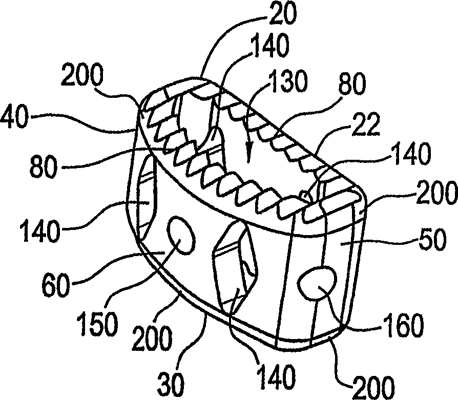 Spinal fusion implant