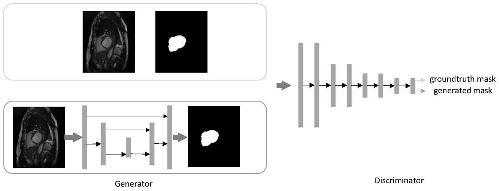 Segmentation method of cardiac structure in MRI images based on multi-channel convolutional neural network