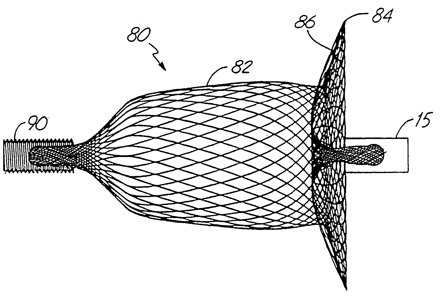 Method and device for filtering body fluid