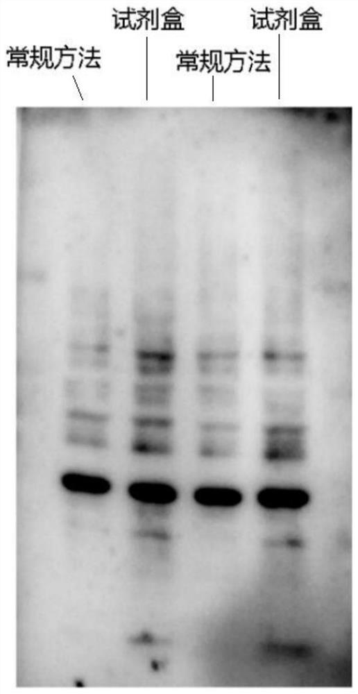 Myristicylation IP enrichment click chemistry kit and use method thereof