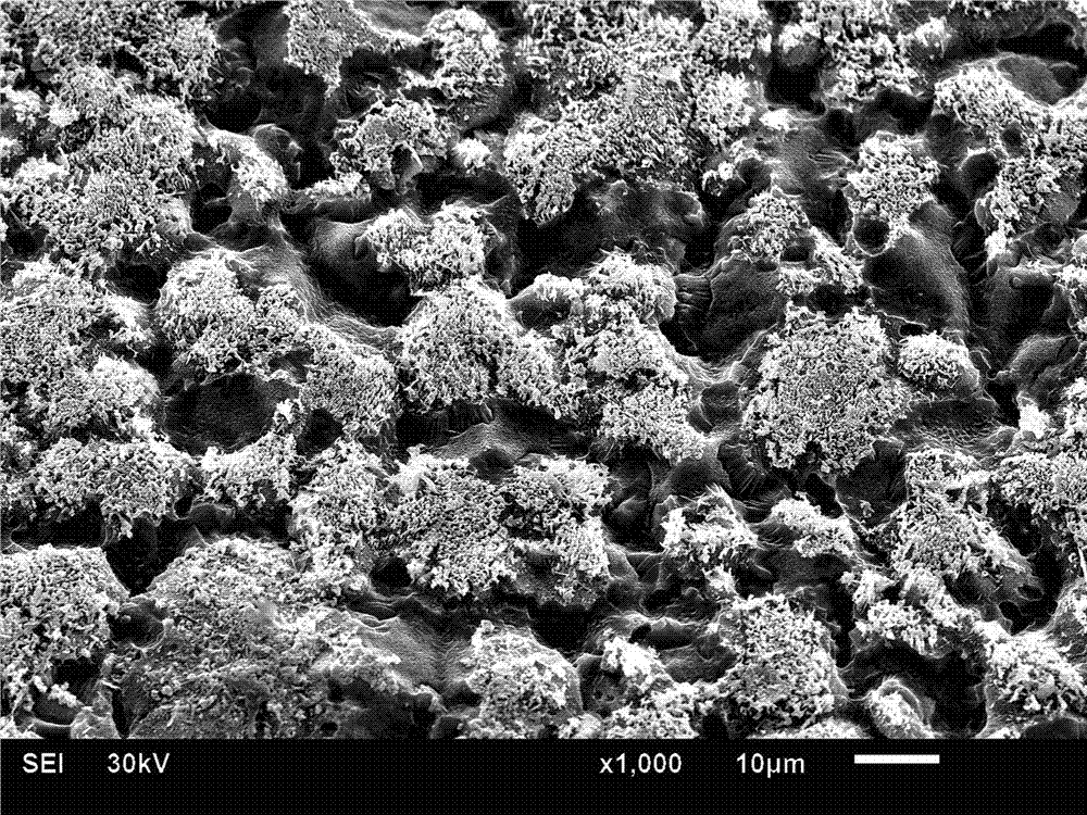 Titanium or titanium-alloy material with micron-nano coarse-structure surface and preparation method thereof