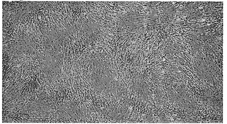 Simplified method for isolation and culture of umbilical mesenchymal stem cells and application thereof in treatment of rheumatoid arthritis