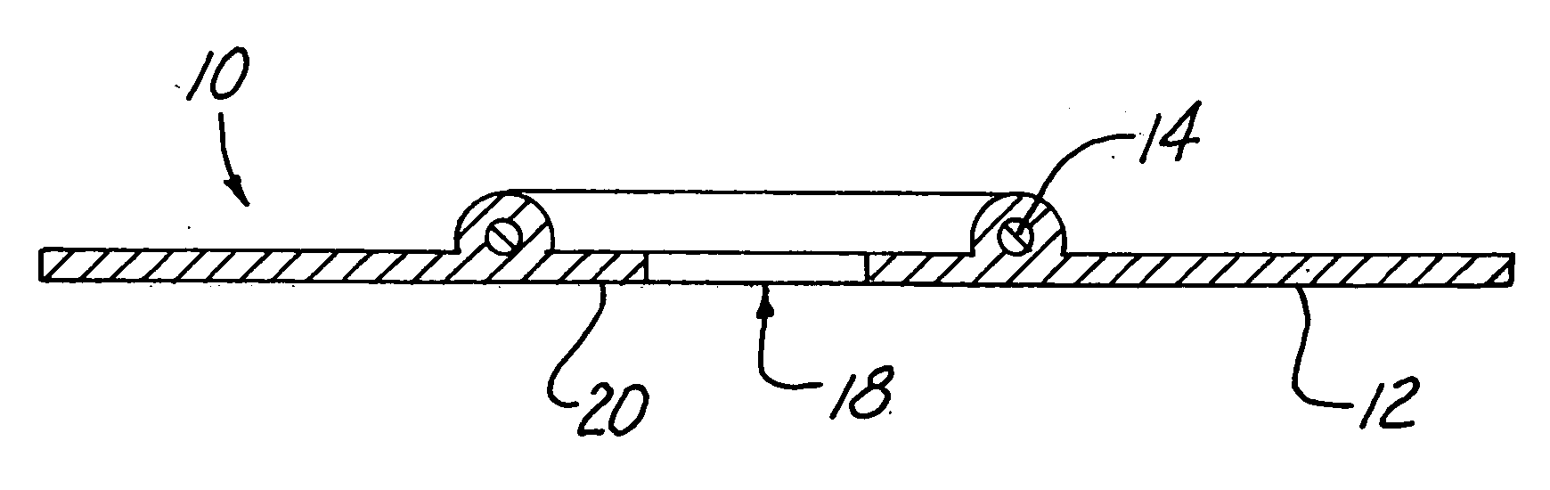 Rubber Dams With Operative Inserts Which Isolate Anatomical Structures by Effectively Resisting External Vector Forces of Displacement