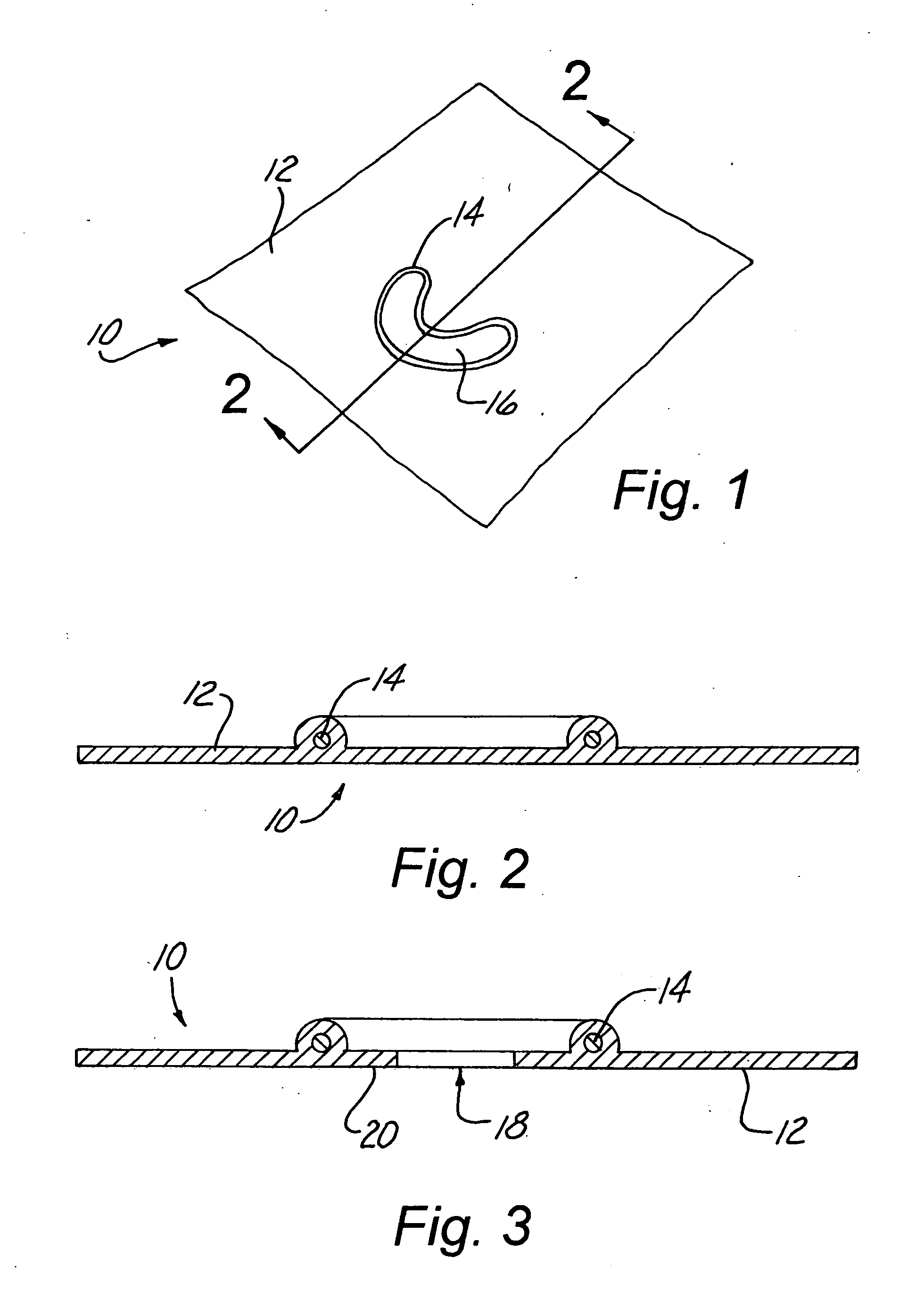 Rubber Dams With Operative Inserts Which Isolate Anatomical Structures by Effectively Resisting External Vector Forces of Displacement