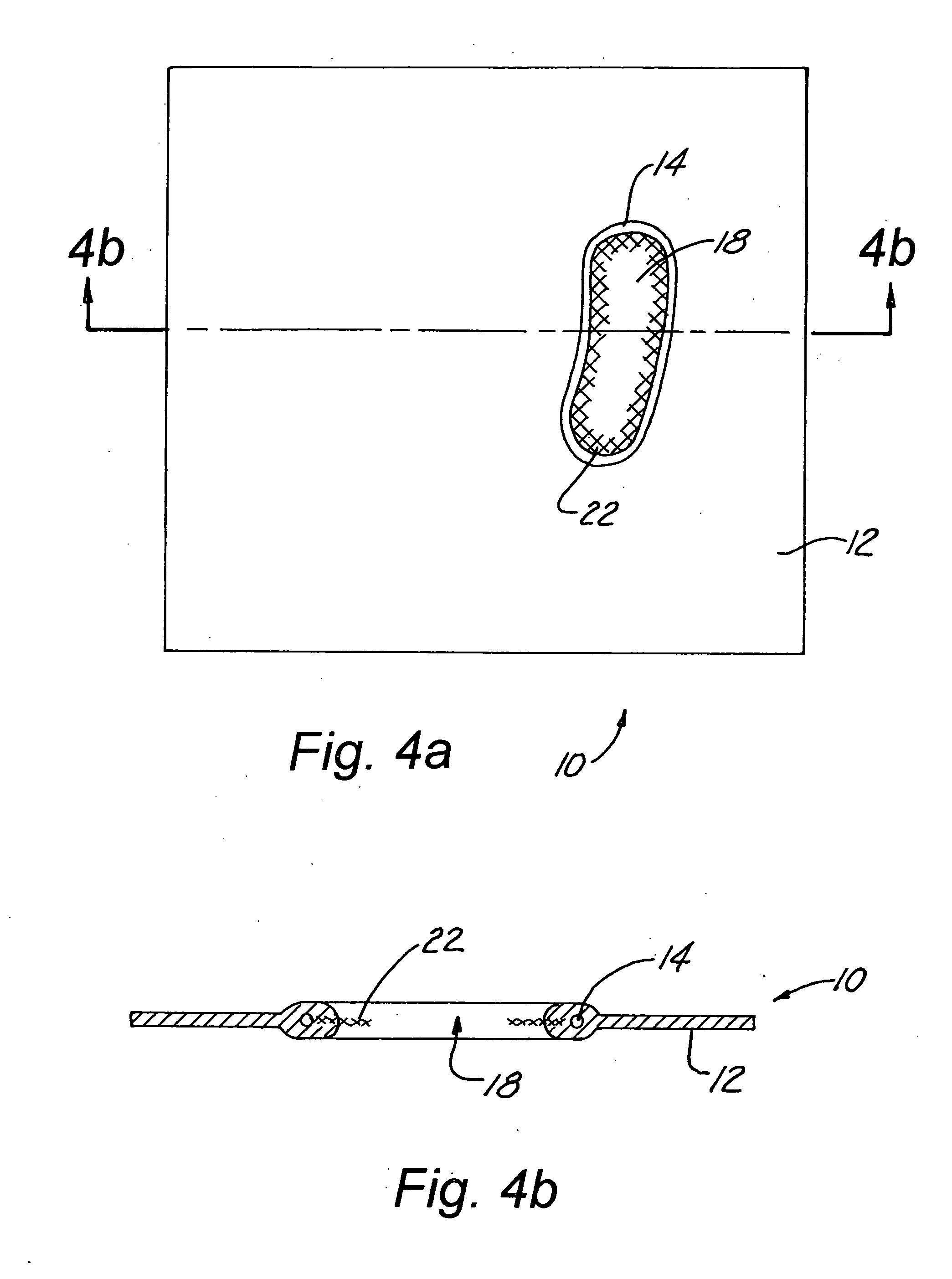 Rubber Dams With Operative Inserts Which Isolate Anatomical Structures by Effectively Resisting External Vector Forces of Displacement