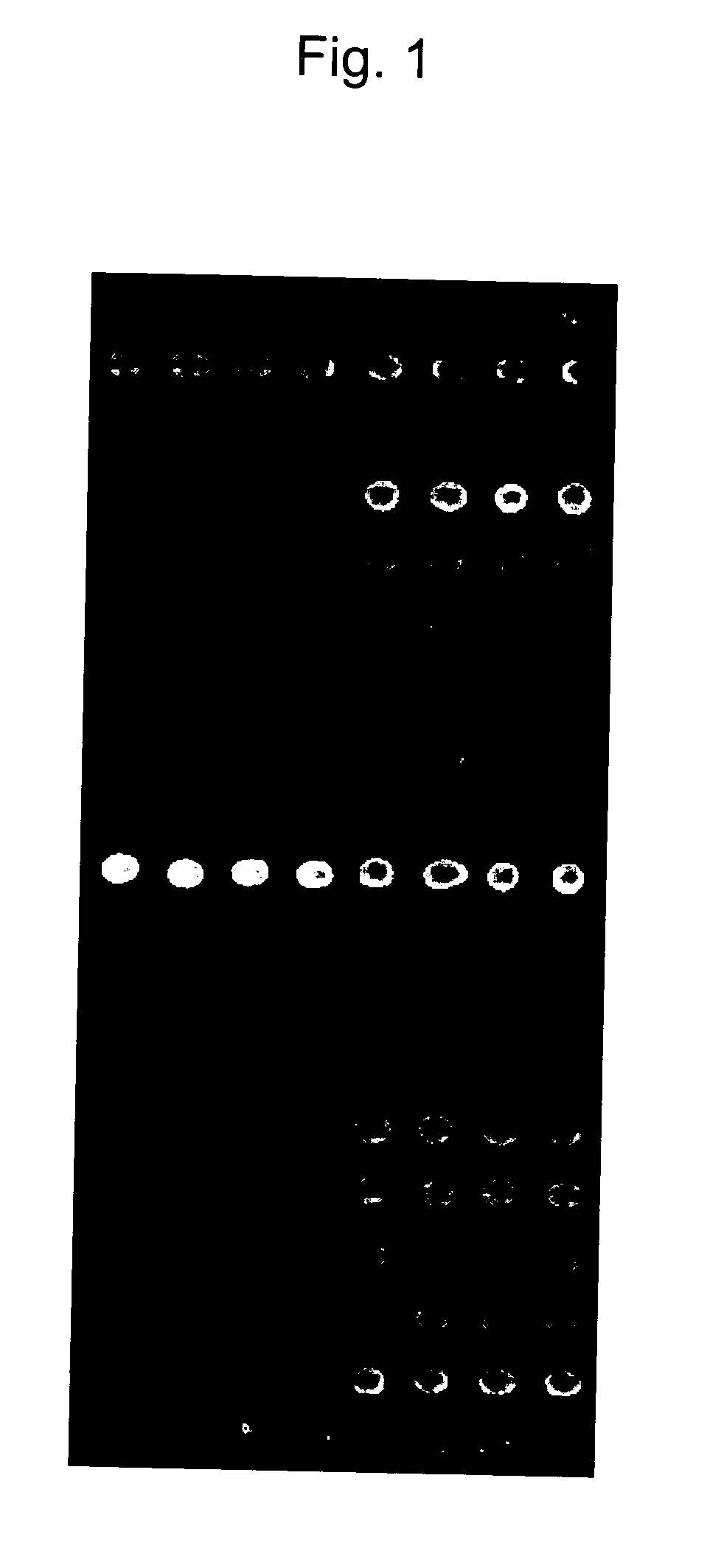 Beta-catenin oligonucleotide microchip and method for detecting beta-catenin mutations employing same