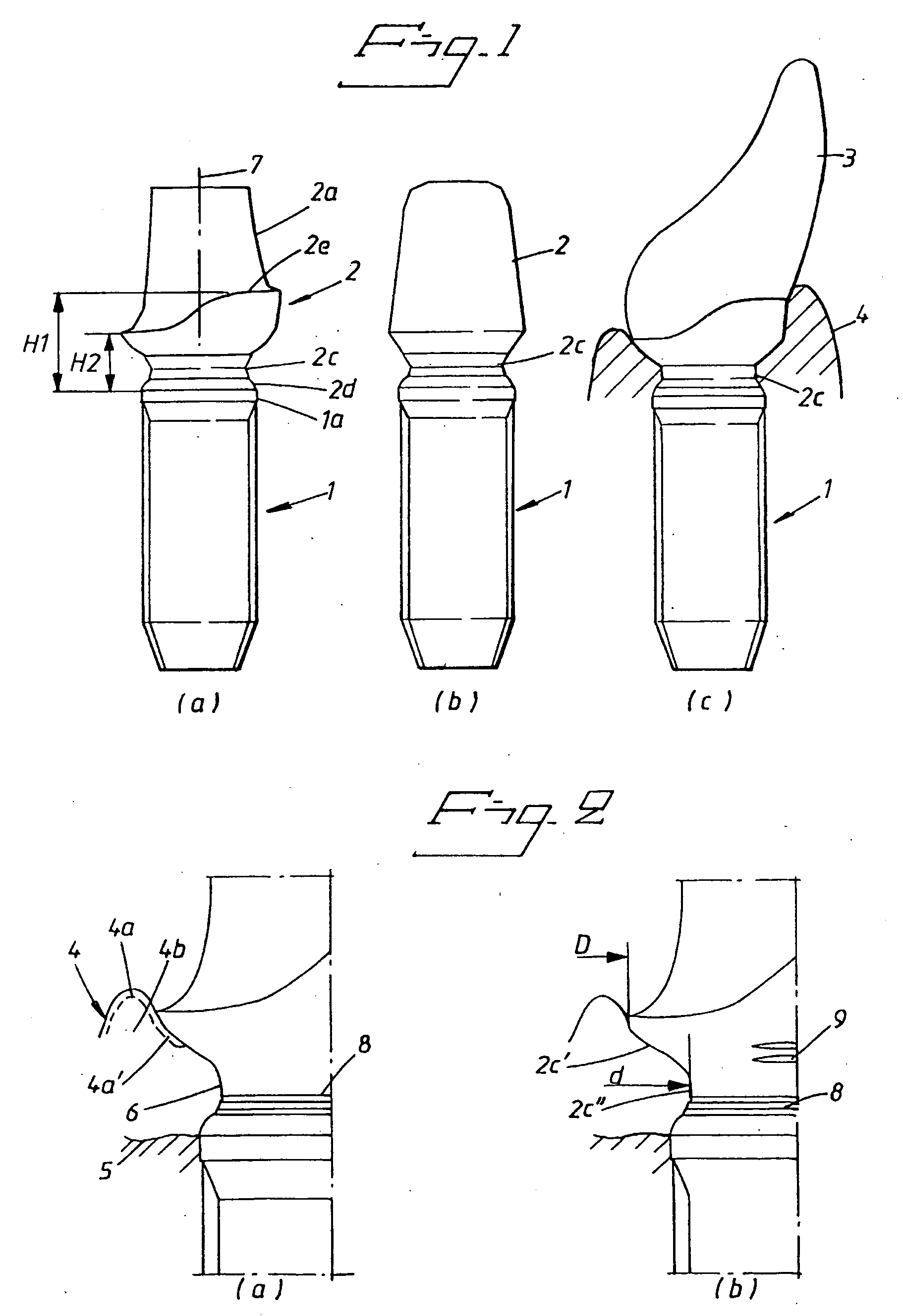 Dental implant arrangement