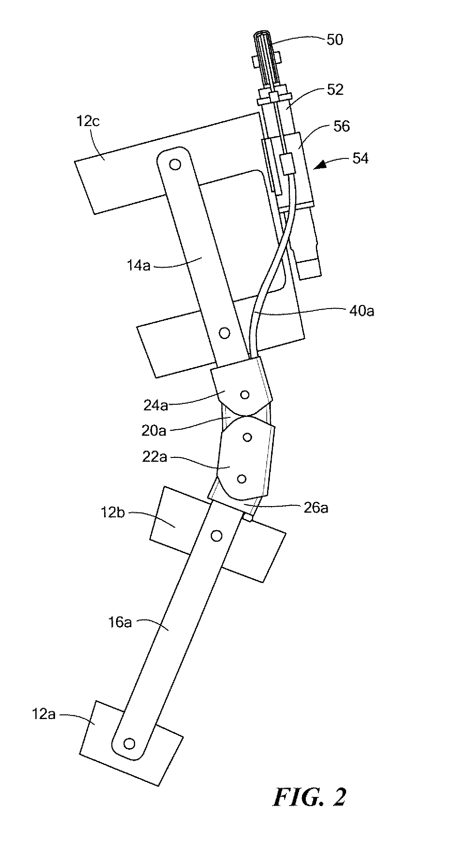 Brace system