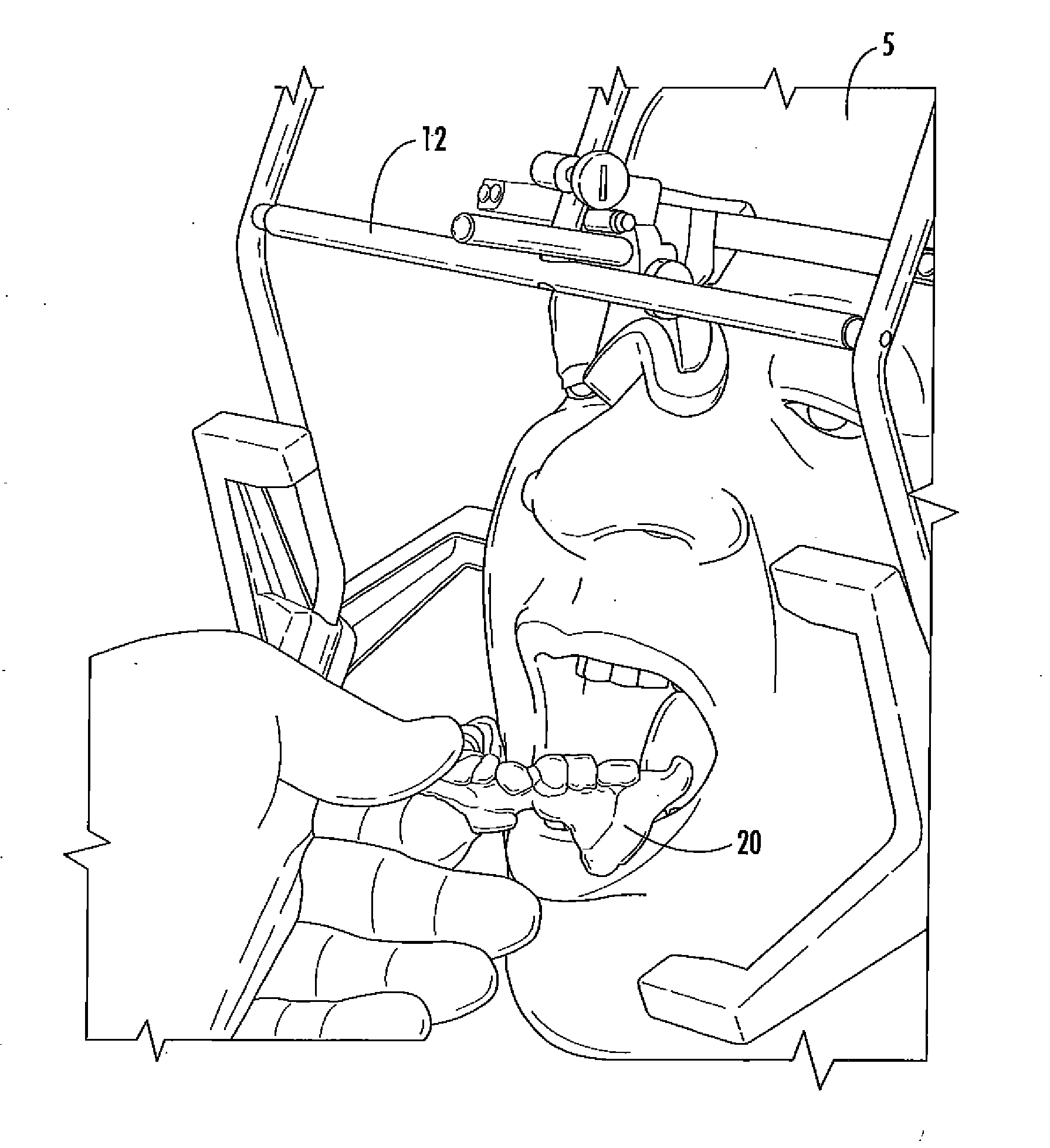 Concussion retarding orthotic and method of producing the orthotic