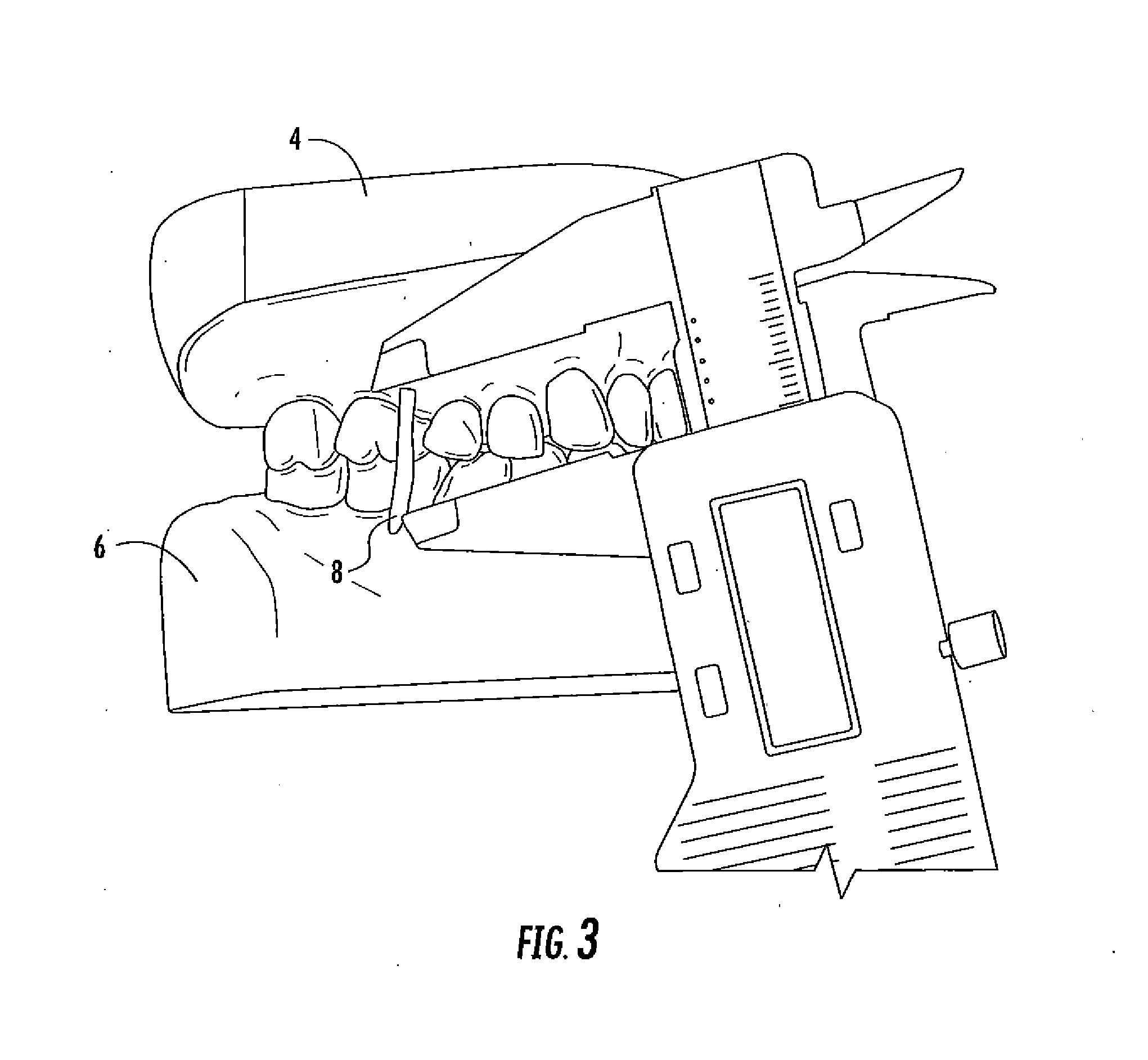 Concussion retarding orthotic and method of producing the orthotic