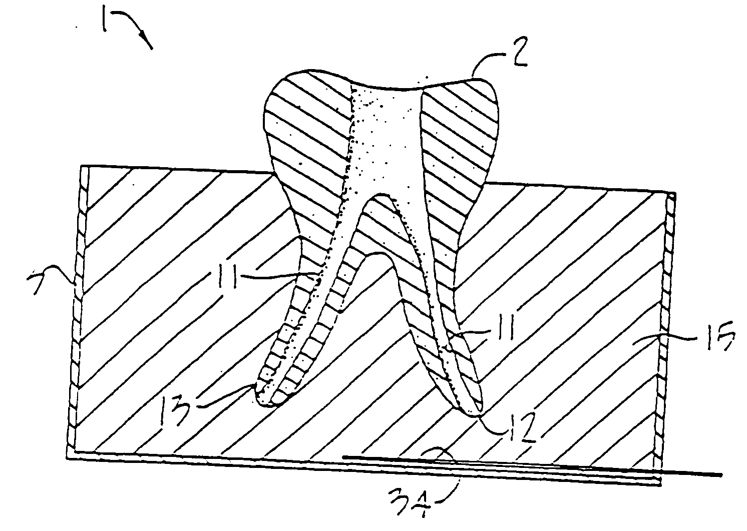 Dental training device