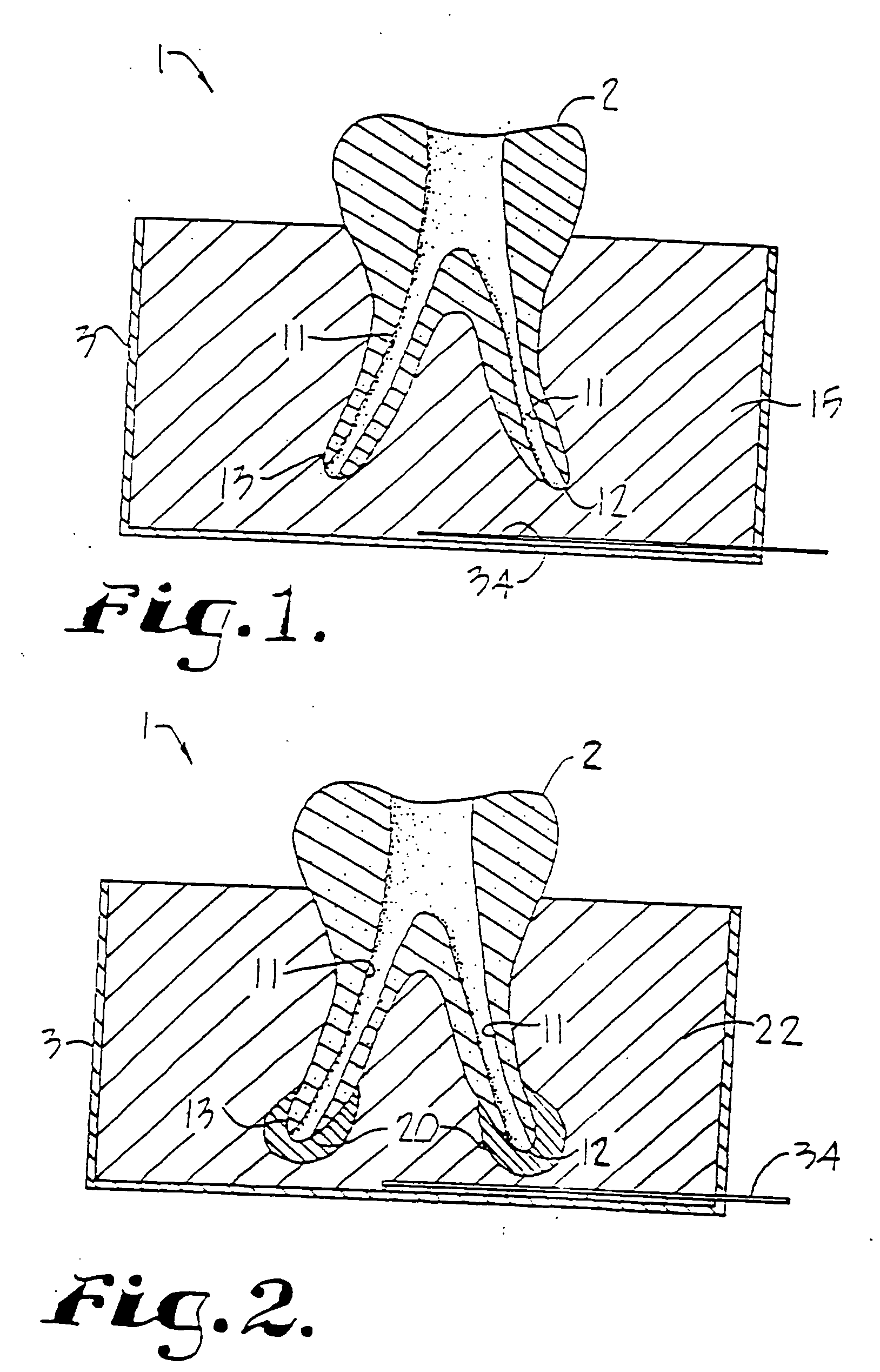 Dental training device