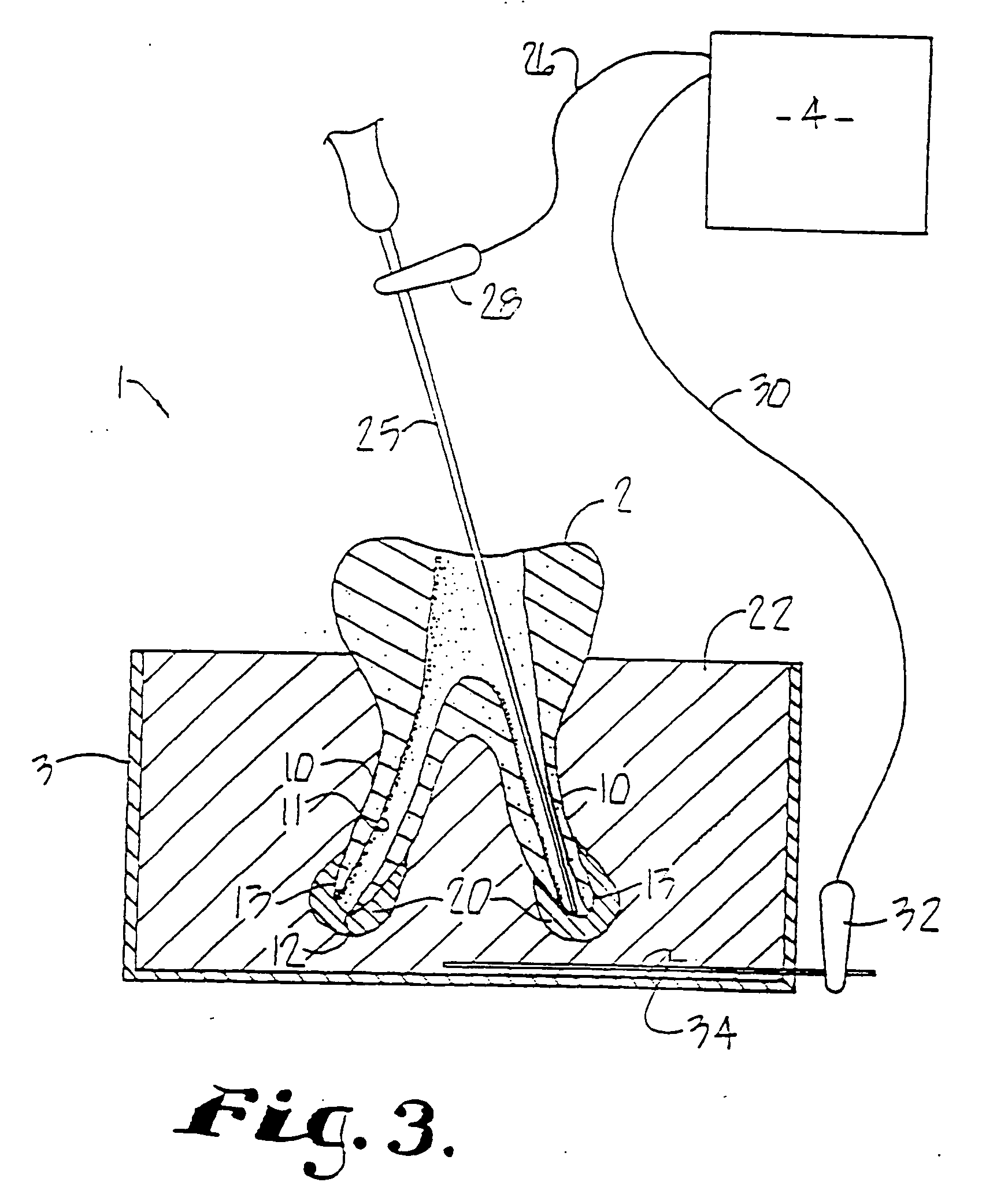 Dental training device