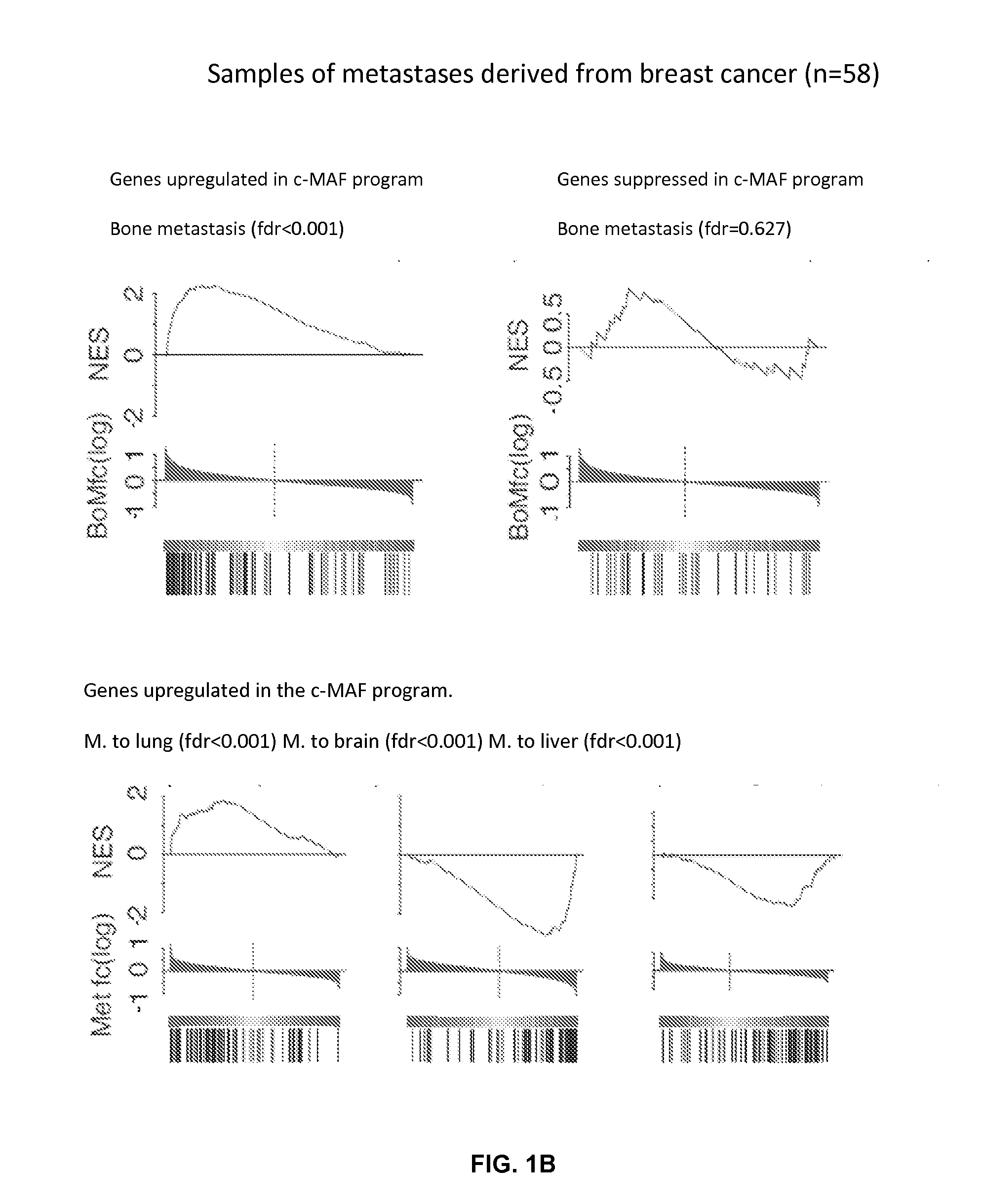 Method for the diagnosis, prognosis, and tratment of cancer metastasis