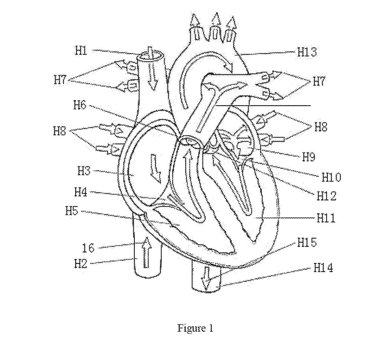 Valve clamp