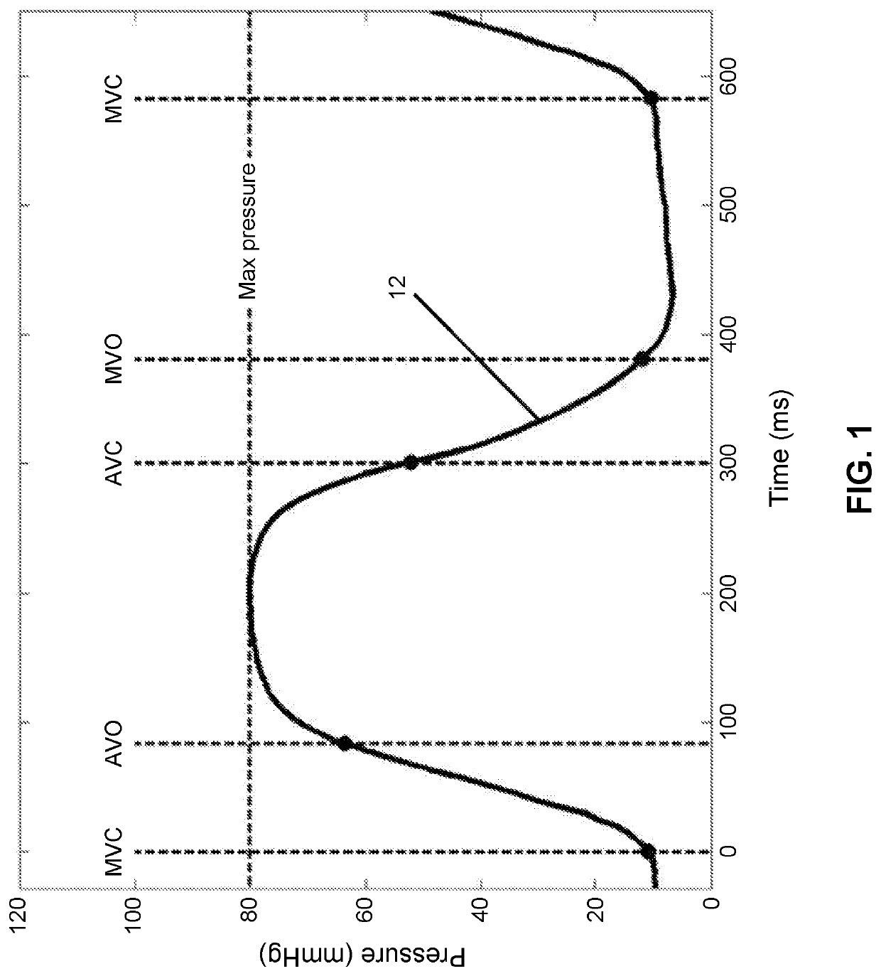 Methods and Apparatus to Estimate Ventricular Pressure