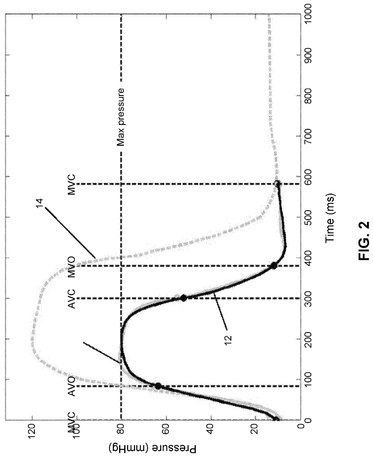 Methods and Apparatus to Estimate Ventricular Pressure