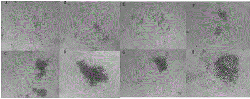 N-containing biheterocyclic acylamide compounds as well as application thereof as immunosuppressor