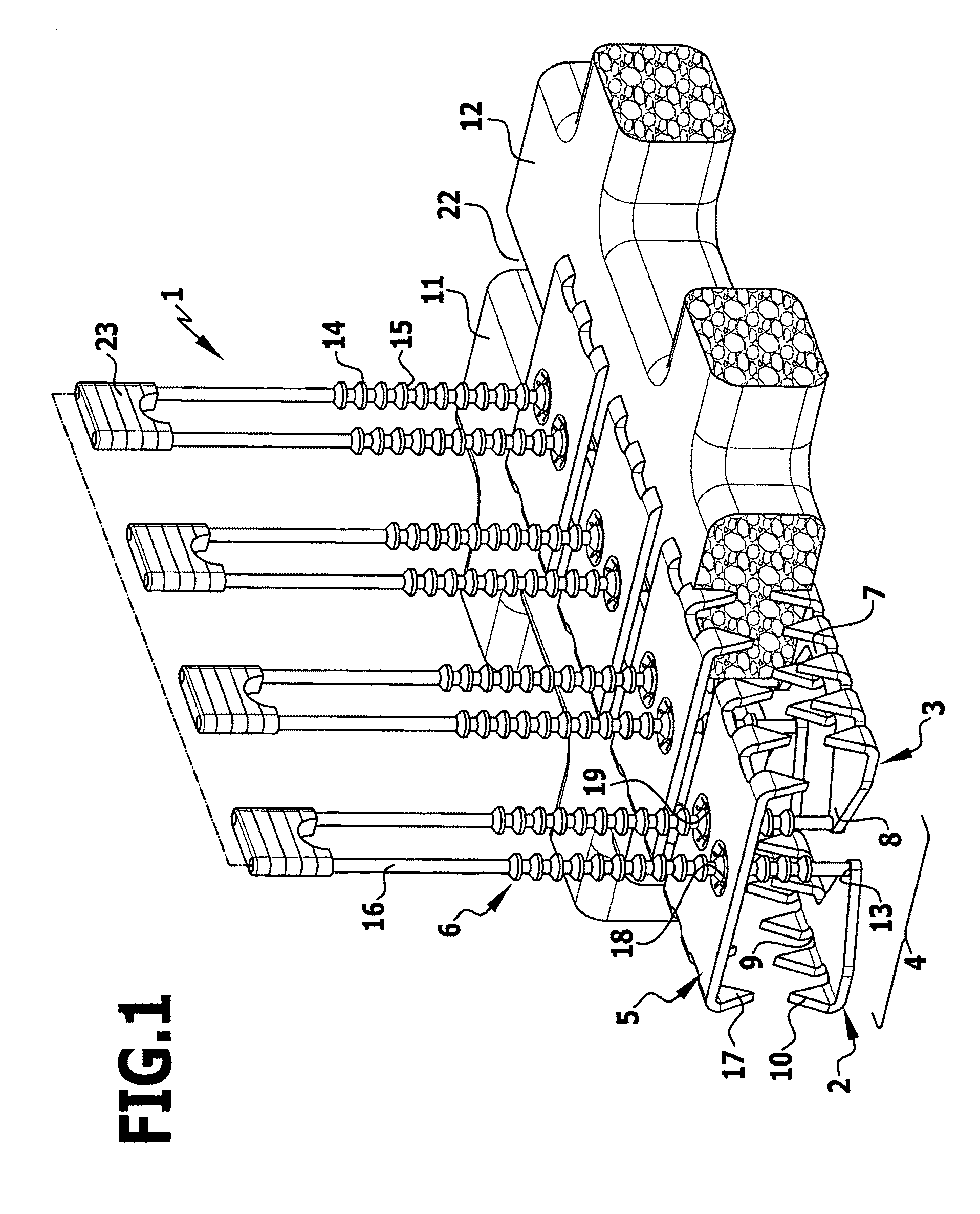 Sternum closure device