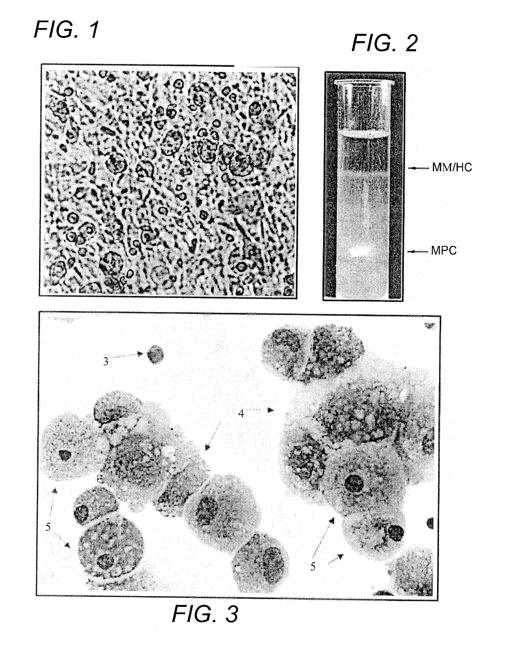 Human Mesenchymal Progenitor Cell