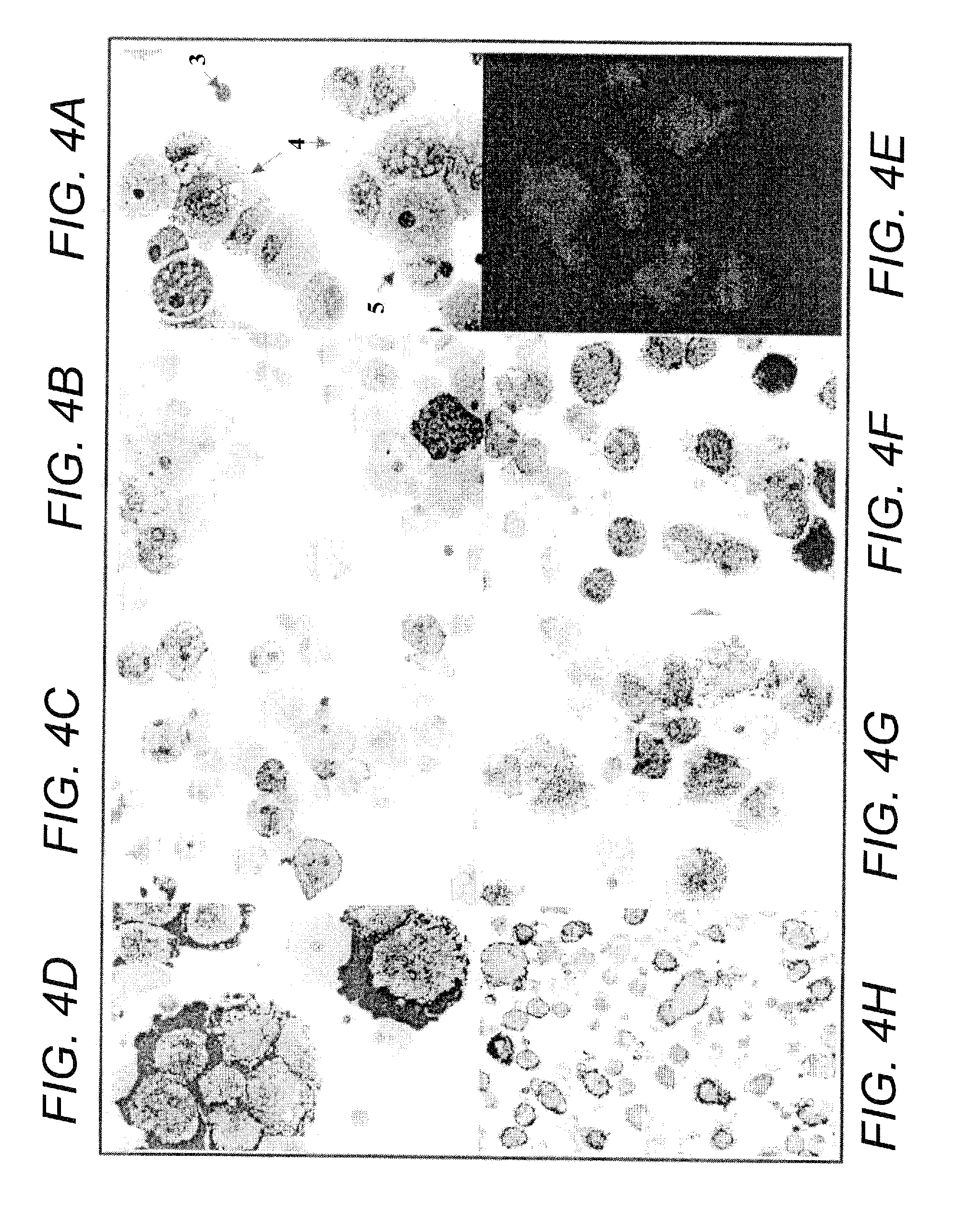 Human Mesenchymal Progenitor Cell