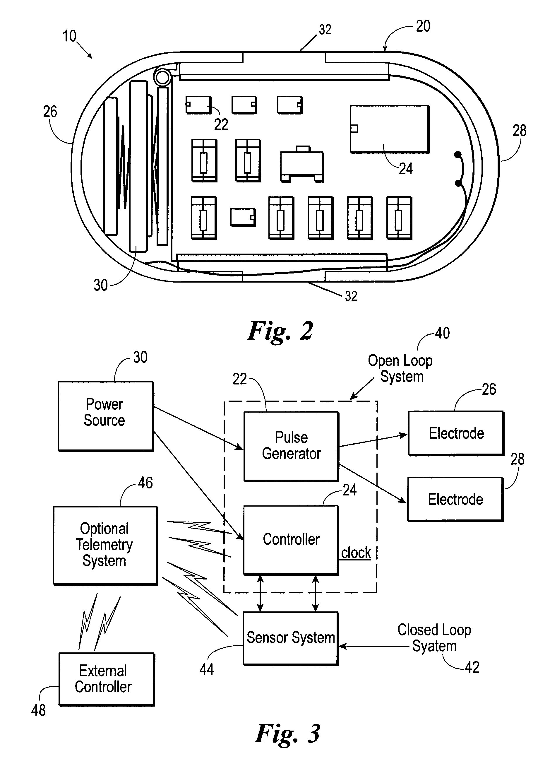 Method of using a gastrointestinal stimulator device for digestive and eating disorders