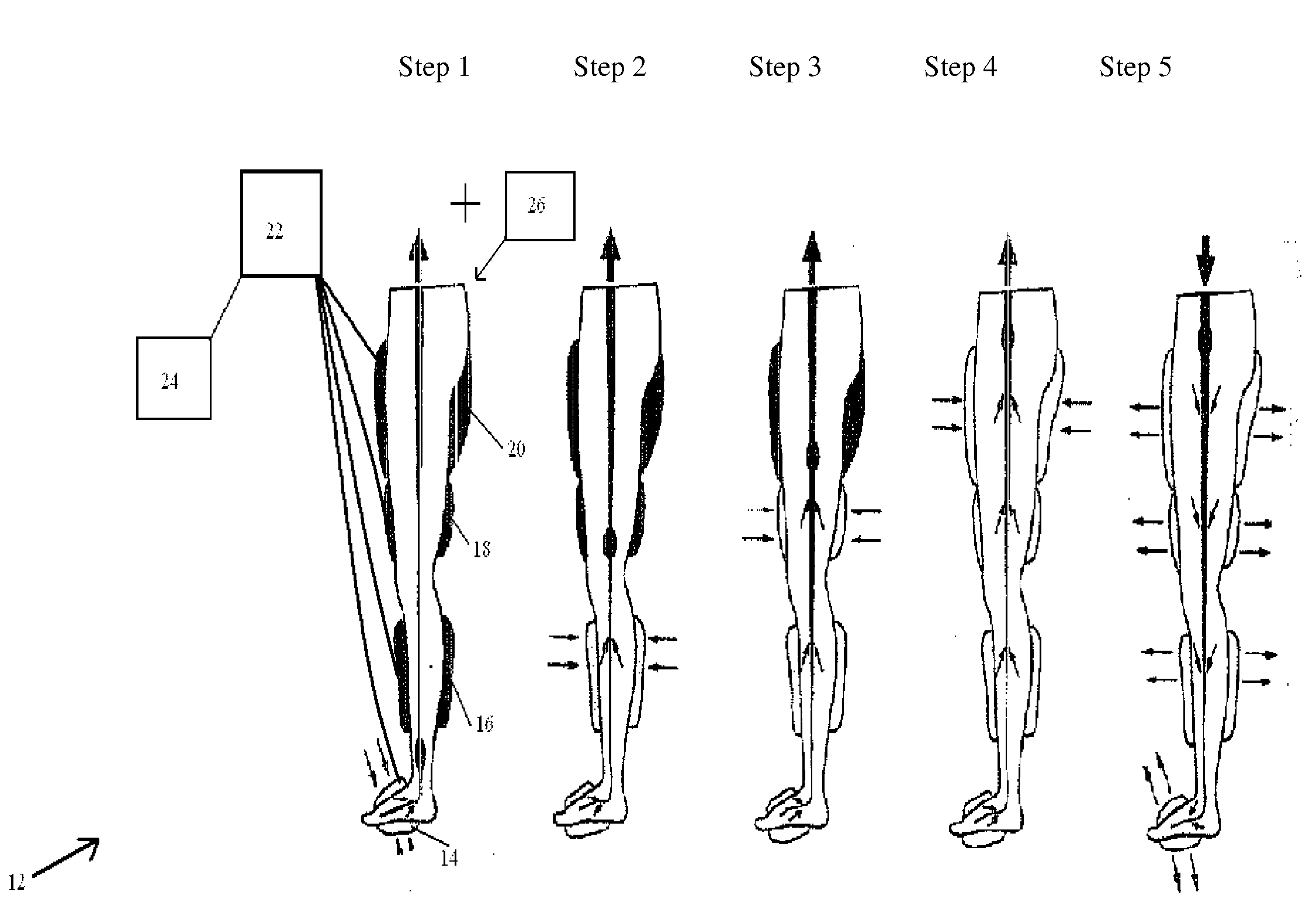 Method and System for Treating Person suffering from a Circulatory Disorder