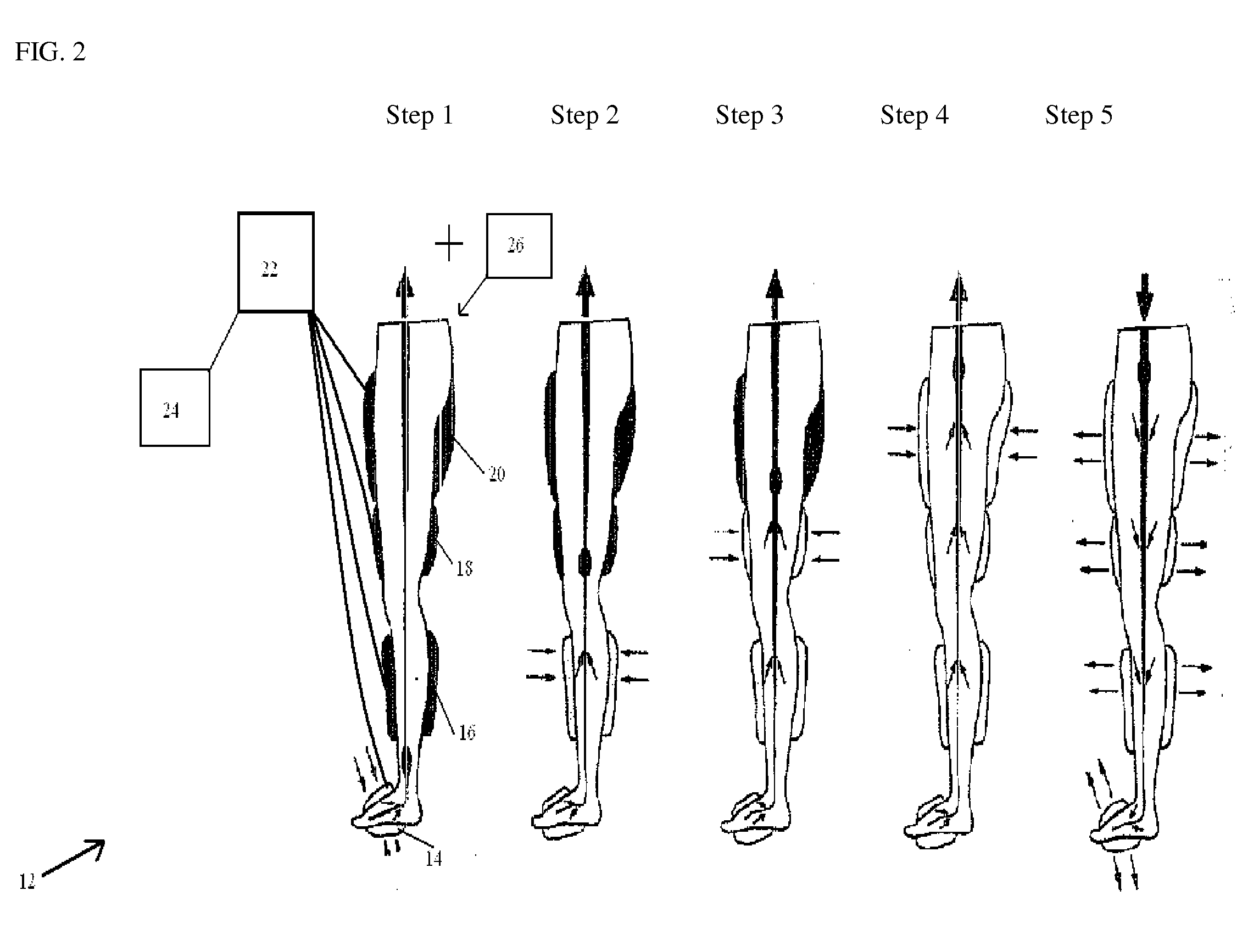 Method and System for Treating Person suffering from a Circulatory Disorder