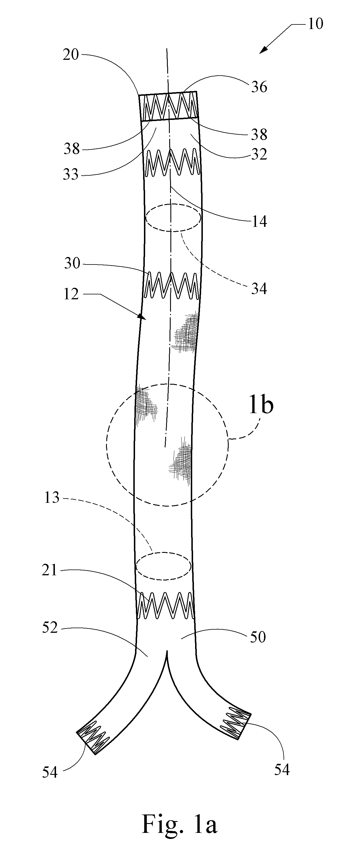 Implantable graft device having treated yarn and method for making same