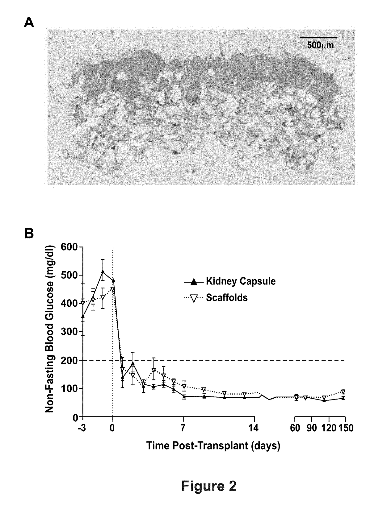 Microporous Hydrogel Scaffolds for Cell Transplantation