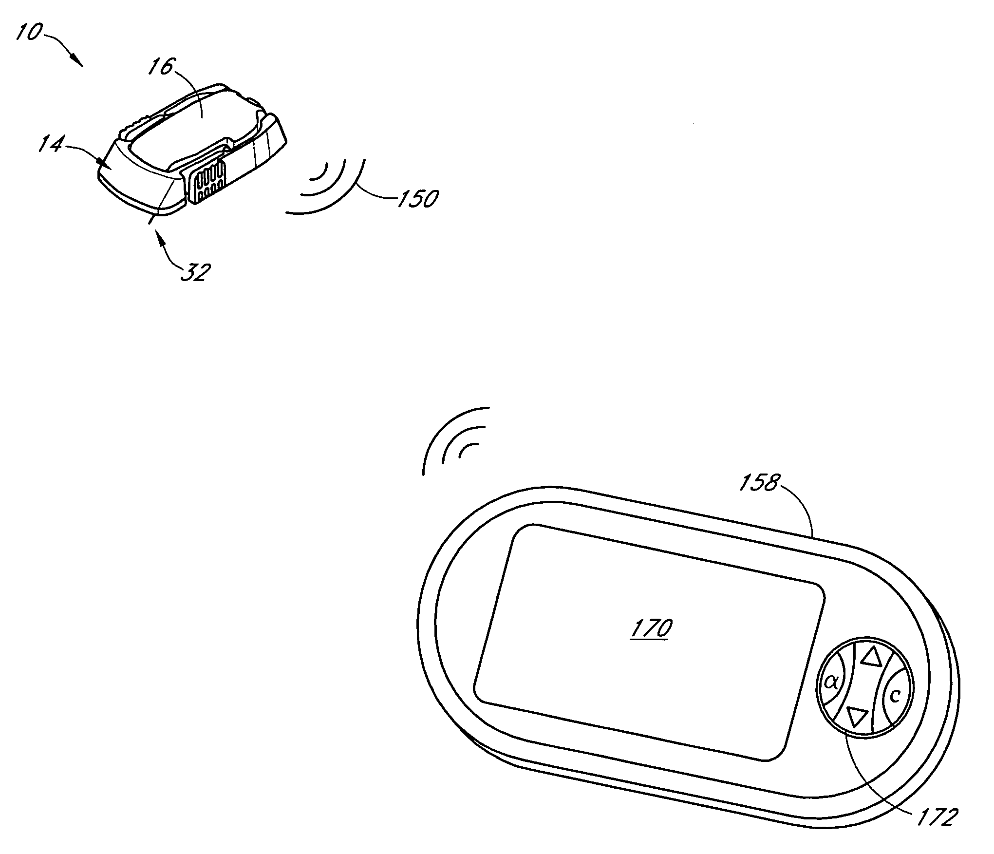 Analyte sensor