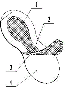 Novel nose breathing device