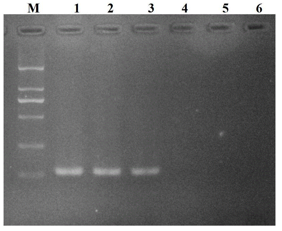 RT-HDA kit and primer for detecting avian influenza virus