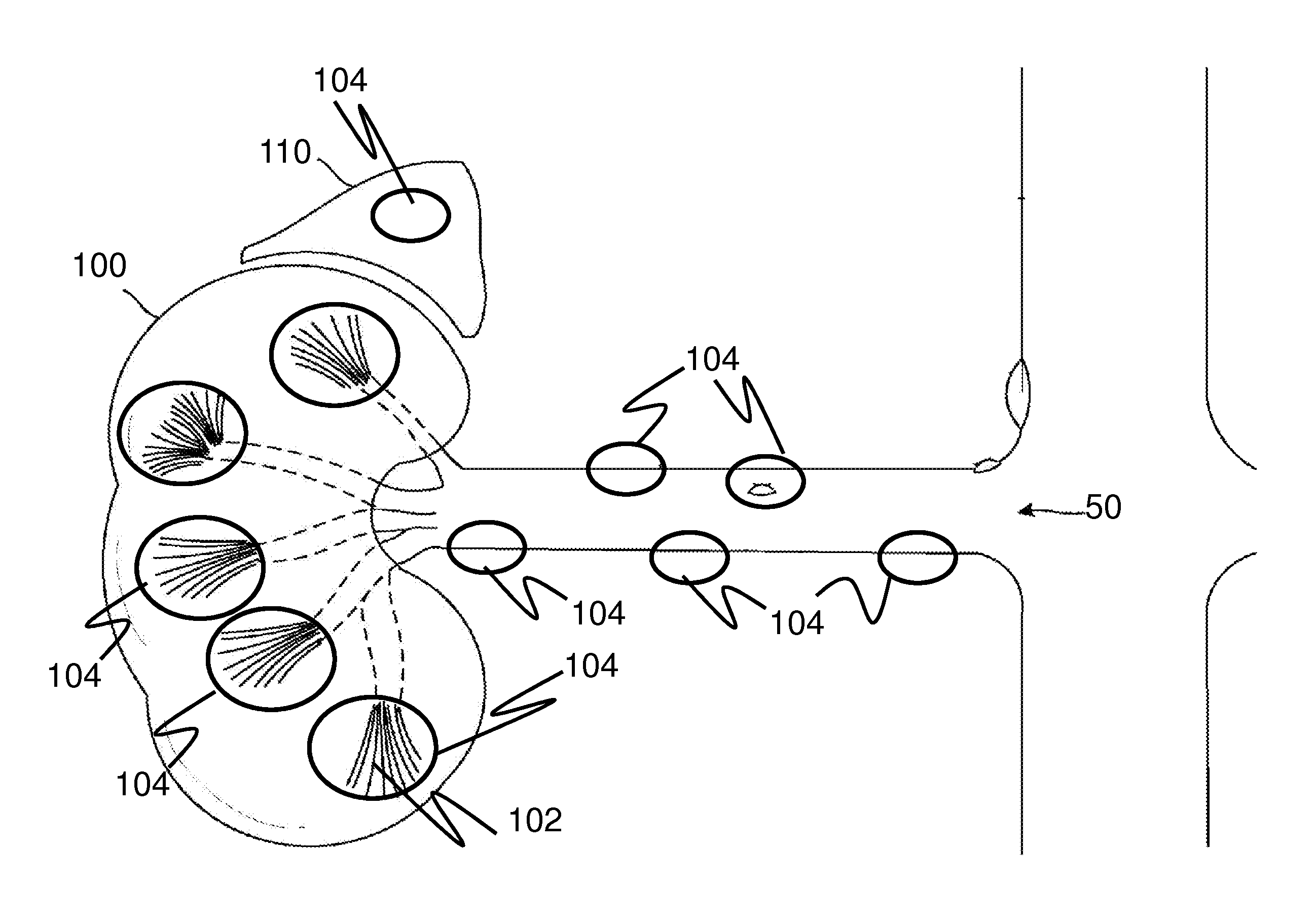 Method for imporoving kidney function with extracorporeal shockwaves