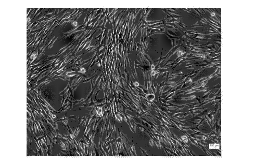 Extraction and multiplication culture method and application of urine mesenchymal stem cells