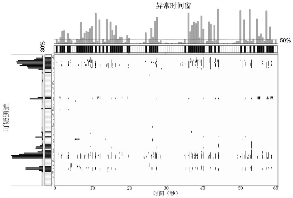 Data extraction method for epilepsy abnormal group activities in interval intracranial electroencephalogram signals