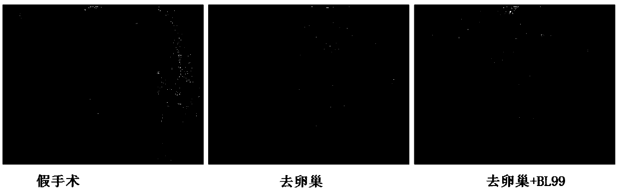 Bifidobacterium lactis-containing fermented dairy product and application thereof