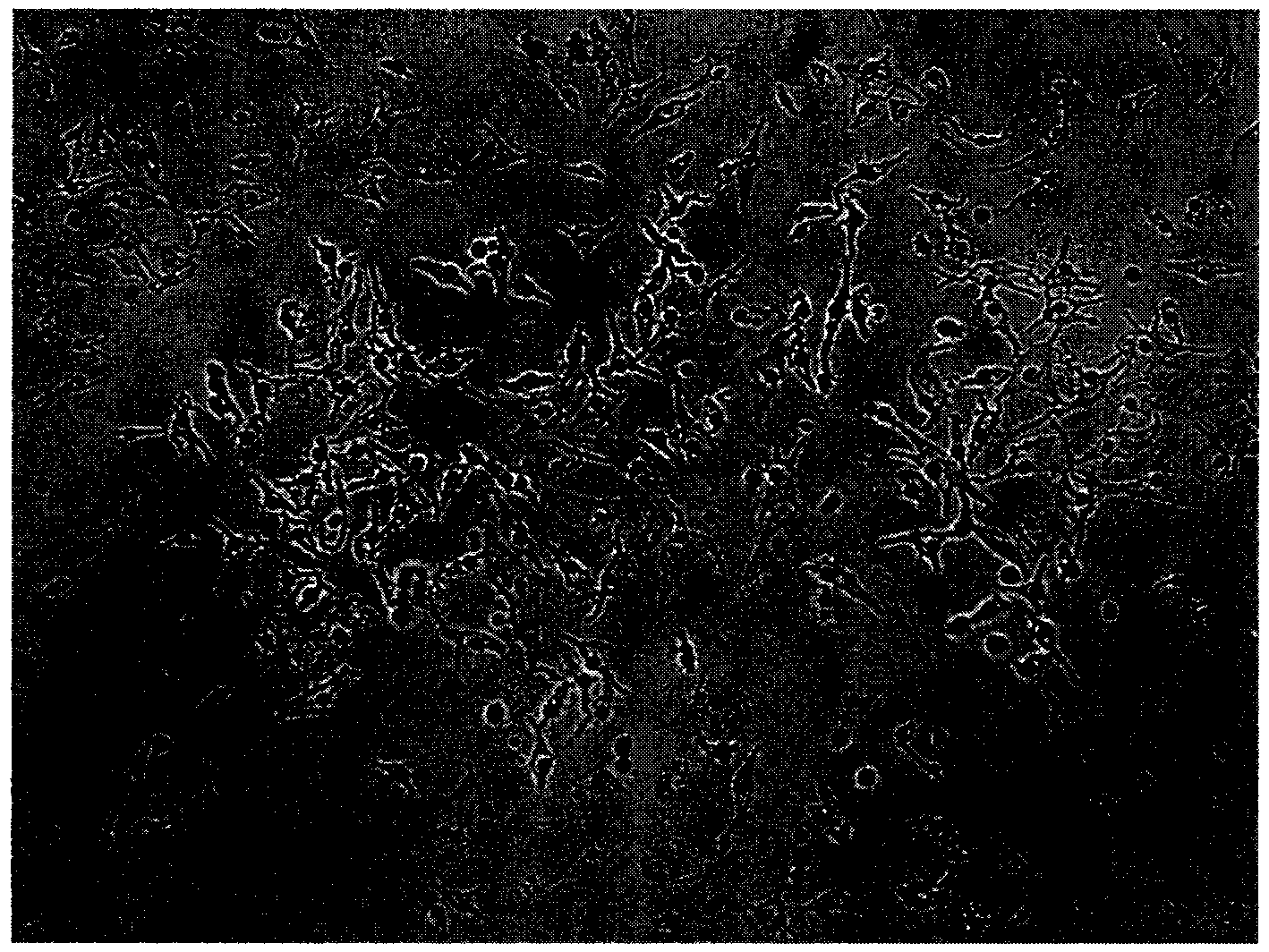 Preparation method of leucoderma melanocyte transplanting coating carrier system